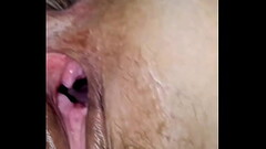 Gaping pussy looking into her cervix Thumb